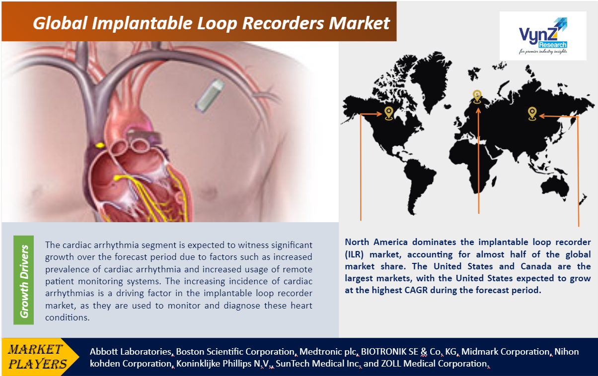 Implantable Loop Recorders Market to hit USD 4.6 billion in 2030